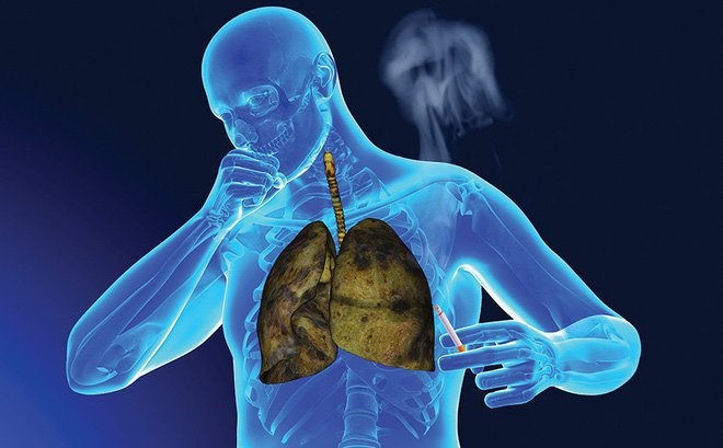 Điều trị tốt các bệnh về phổi