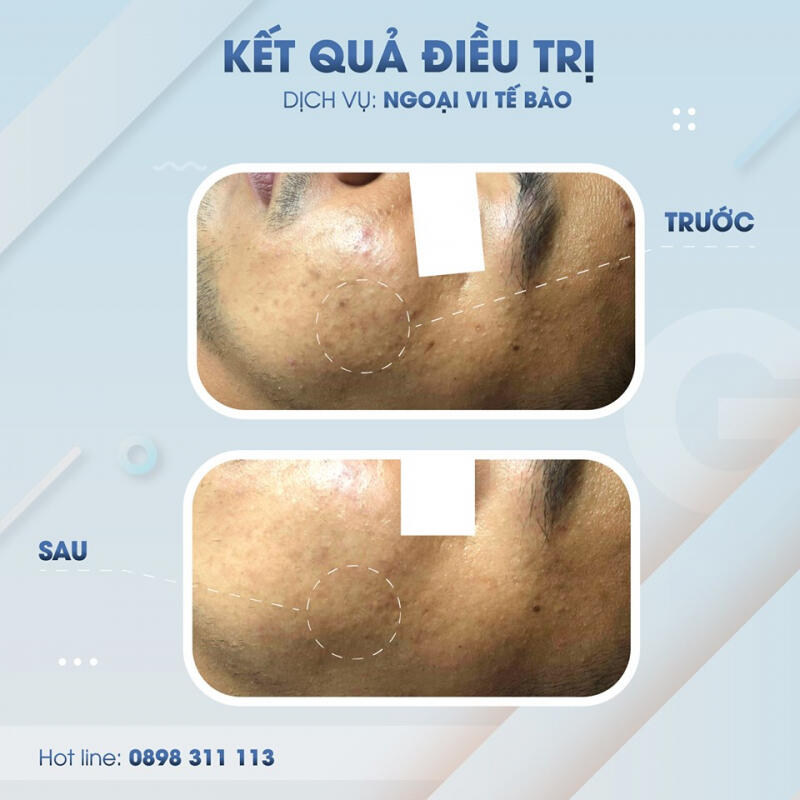Gà Spa Quy Nhơn