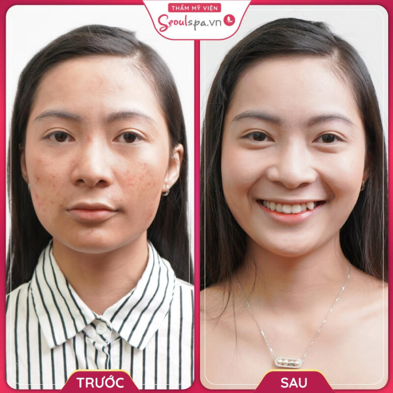 Seoul Spa Vũng Tàu