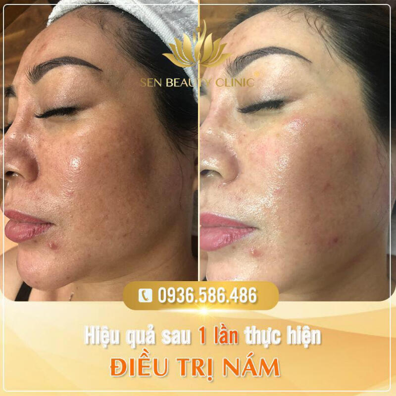 Sen Spa & Clinic Vũng Tàu