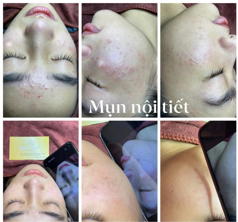 Queen Spa