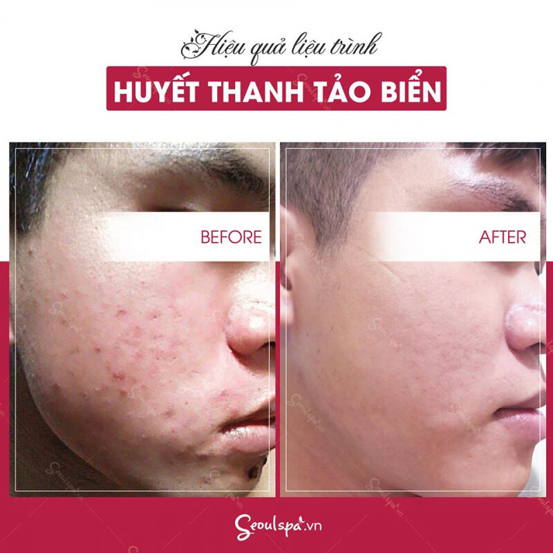 Thẩm Mỹ Viện SeoulSpa.Vn Đà Nẵng