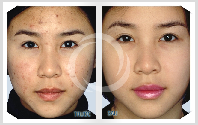 Thẩm Mỹ Đông Á