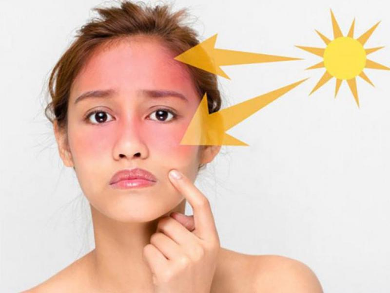 Ngăn ngừa tác động của tia cực tím