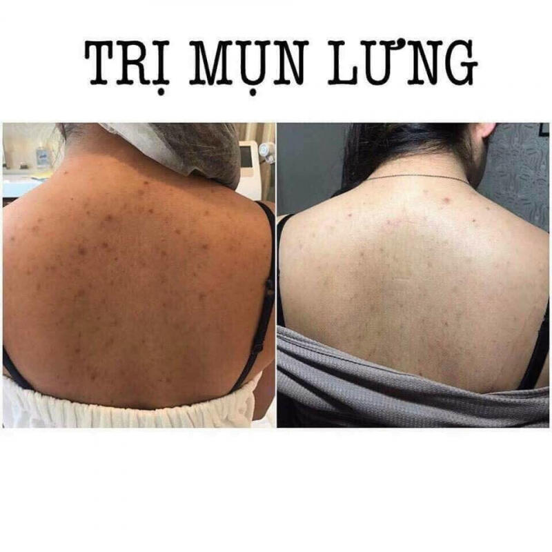Huệ Spa - Huệ Nguyễn