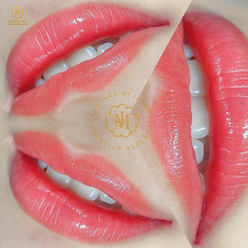 JangMi - Viện Thẩm Mỹ