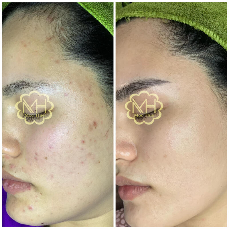 Mộc Huệ Beauty & Clinic