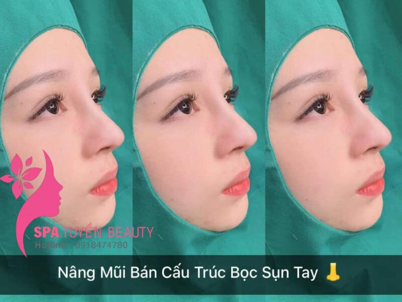 Spa Tuyền beauty