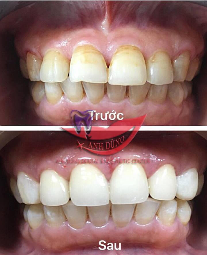 Trung tâm Nha khoa & Thẩm mỹ Anh Dũng