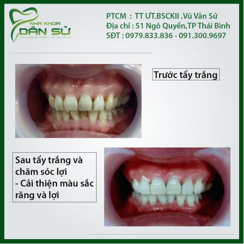Nha Khoa Dân Sử