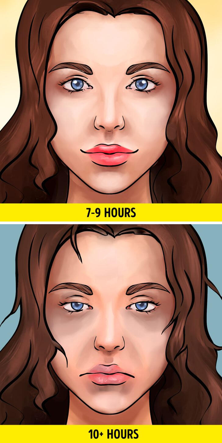 Bạn có thể bị chứng ngủ quá nhiều (hypersomnia)