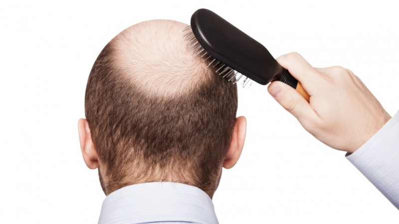 Truyện cười về làm đẹp số 5