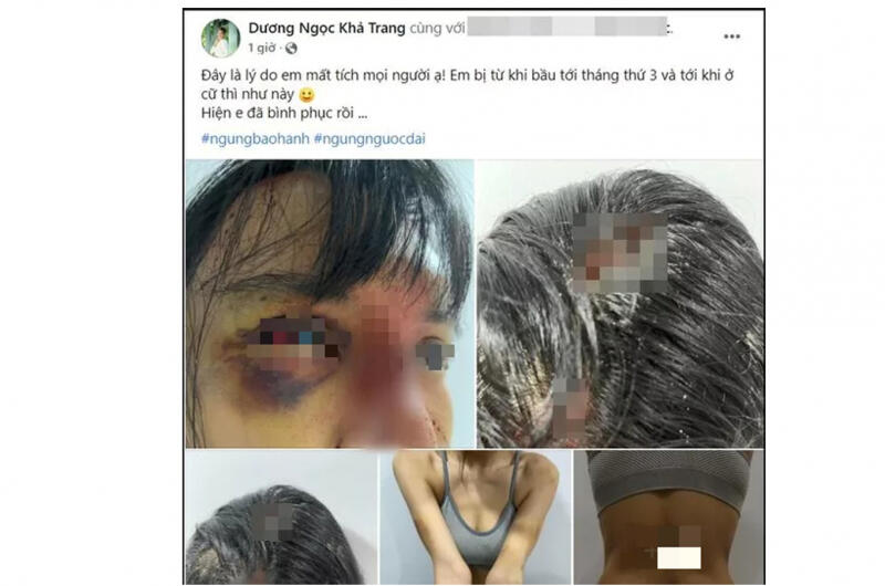 Siêu mẫu Khả Trang bất ngờ xuất hiện với thương tích đầy mình (1/12/2021)
